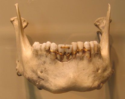 Povijest ortodoncije