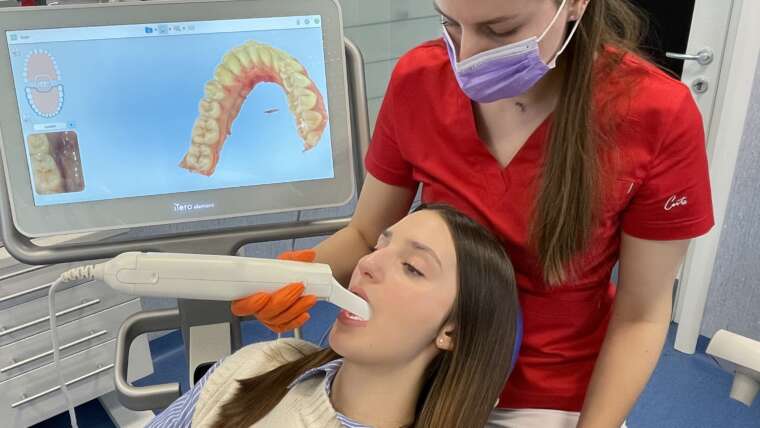 Skeniranje zubi za Invisalign aparatić